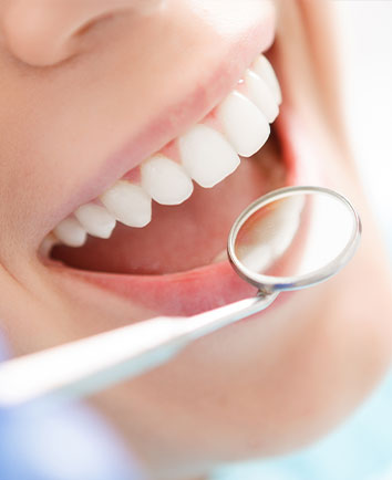 虫歯や歯周病を予防し健康なお口に 予防歯科