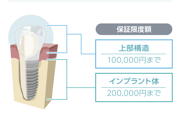 保証画像